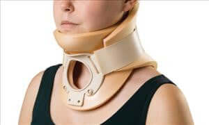 Tracheotomy Philadelphia cervical collar in beige worn on a person's neck, featuring a front opening cutout