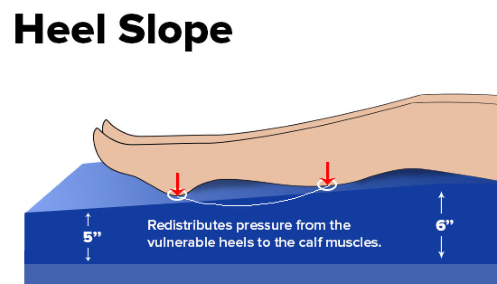 Heel slope diagram showing a leg resting on a wedge-shaped foam mattress overlay, with arrows indicating pressure
