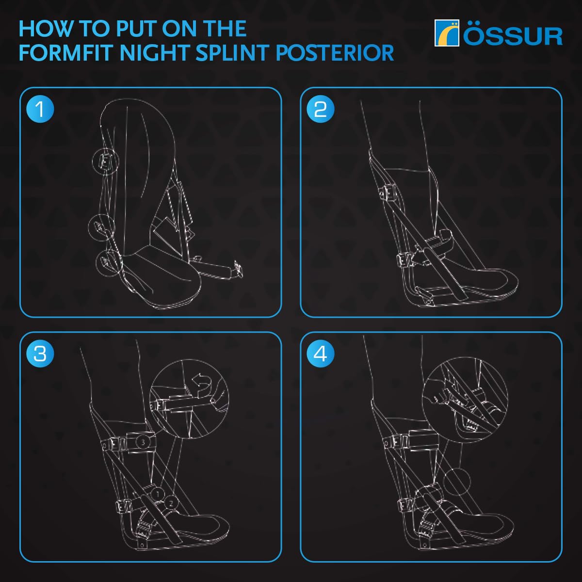 Night splint posterior fitting instructions showing four illustrated steps for applying the brace to a foot and lower leg